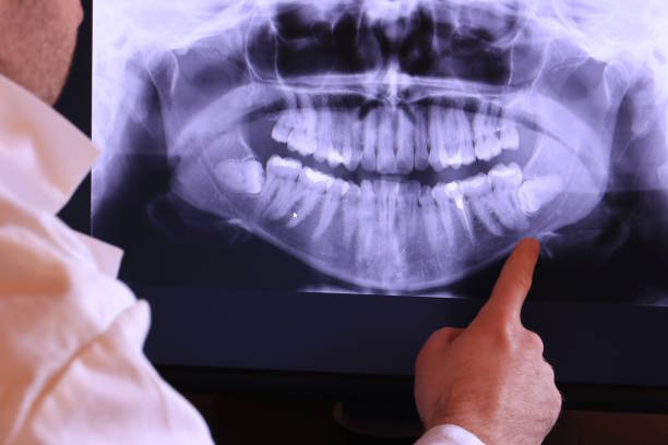 Best Emergency Treatment for Toothache in Brillion, WI